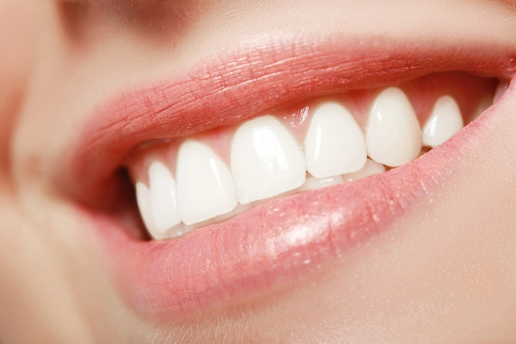 Cosmetic dentistry smile enhancement at New Beam Dental in Port Coquitlam