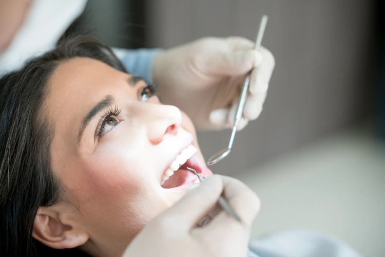 Tooth-colored dental filling restoring a cavity at New Beam Dental in Port Coquitlam